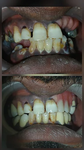 Pooja Smile Care Dental Gallery Image 13